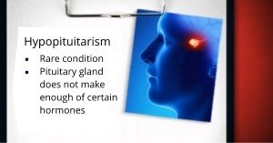 Hypopituitarism Newport Beach & Orange County, CA