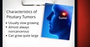 Robert Louis, MD, treats Pituitary Tumors