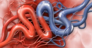 Glossopharyngeal Neuralgia Newport Beach & Orange County, CA