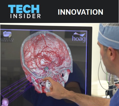 Revolutionary Way for Brain Surgeons
