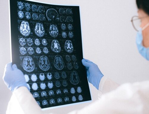 Brain Surgery: Purpose, Types, and Risks