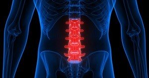 Lumbar Spine Surgery Newport Beach